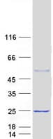 Human CAPSL Protein (Recombinant Myc-DDK (Flag))