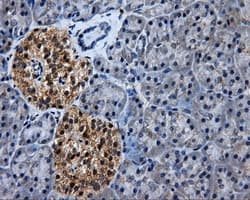 HSD17B10 / HADH2 Antibody (clone OTI10B4)
