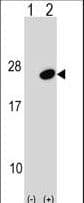 UBE2G1 Antibody (aa127-155)