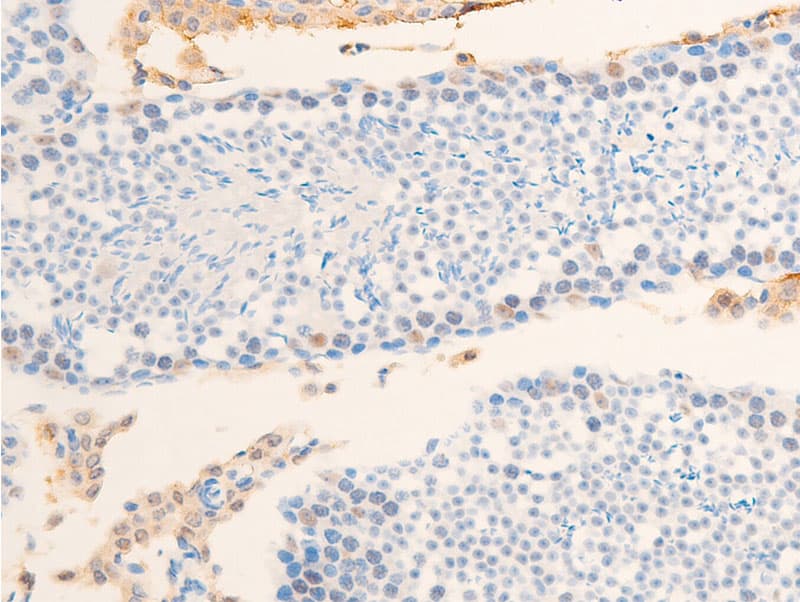 BIRC5 / Survivin Antibody (phospho-Thr117)