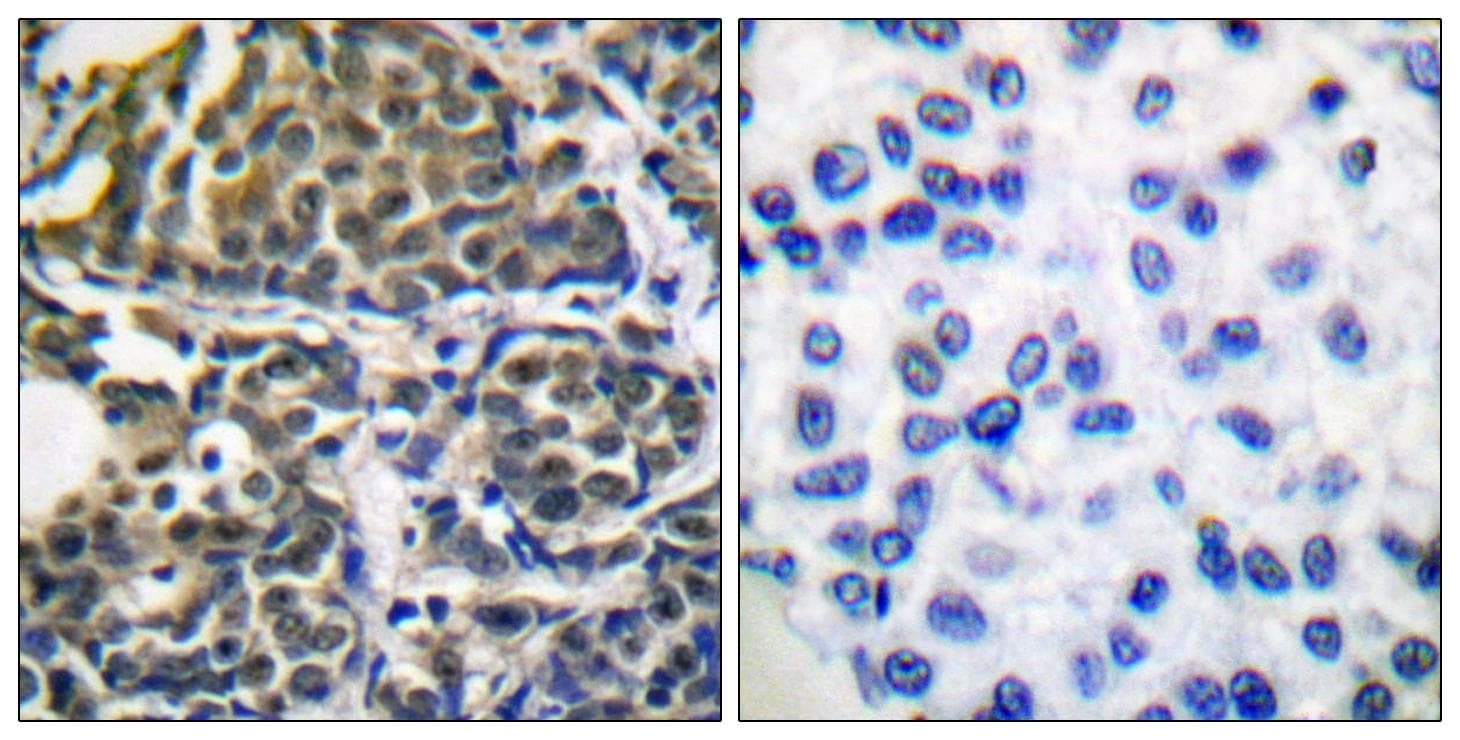Polyclonal Rabbit anti-Human HSP90AB1 / HSP90 Alpha B1 Antibody (p254, IHC, IF, WB)