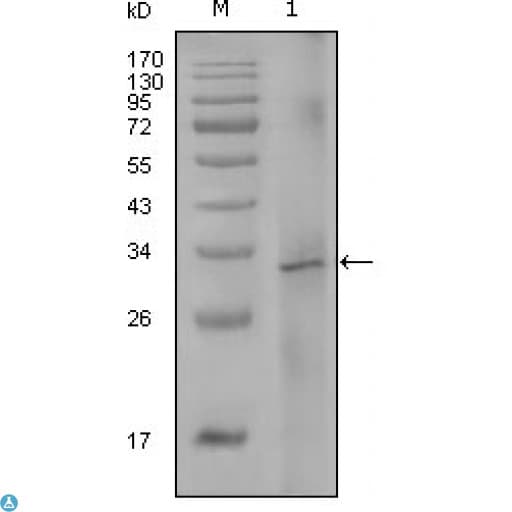 F8 / FVIII / Factor VIII Antibody