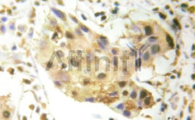 Polyclonal Rabbit anti-Human CHEK2 / CHK2 Antibody (IHC, IF, WB)