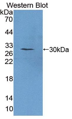 Securin / PTTG1 Antibody (aa2-199)