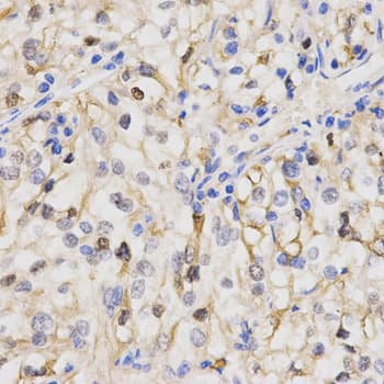 PPP2R4 Antibody