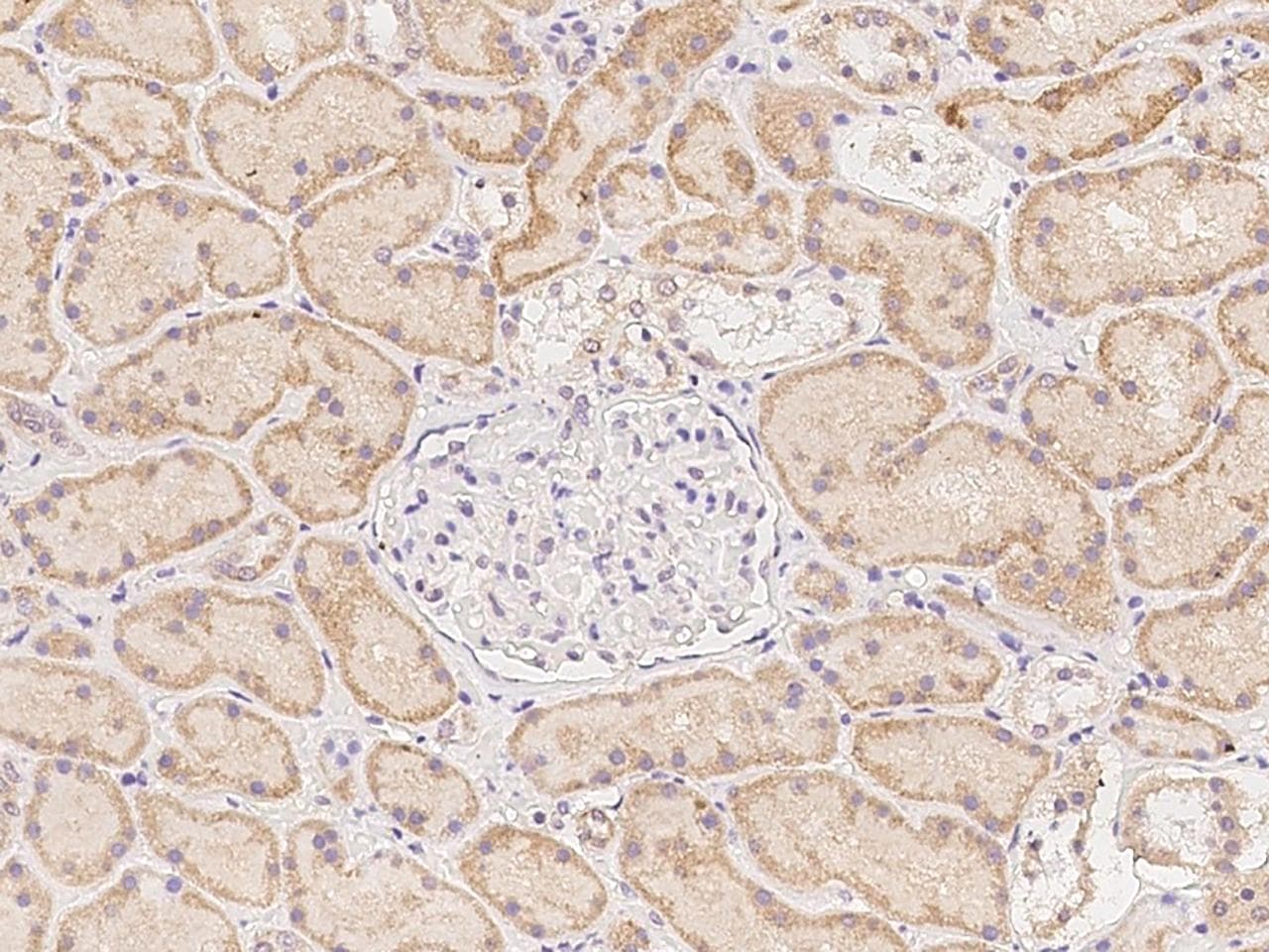 KIAA1755 Antibody