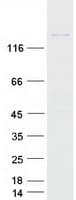 Human SCOP / PHLPP Protein (Recombinant Myc-DDK (Flag))