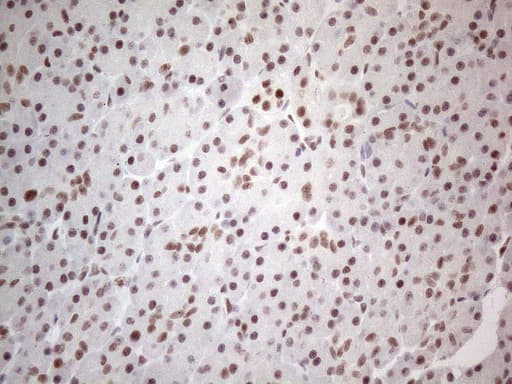 NR2C2 / TAK1 Antibody (aa1-241, clone OTI4B1)
