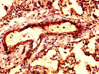 Polyclonal Rabbit anti-Human ARPC4 Antibody (IHC, IF)