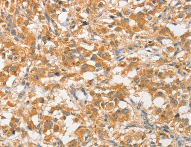 Polyclonal Rabbit anti-Human APG5 / ATG5 Antibody (IHC, WB)