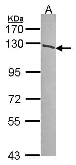 Polyclonal Rabbit anti-Human PARP1 Antibody (IF, WB)