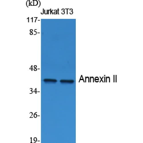 ANXA2 / Annexin A2 Antibody (Internal)