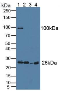 GCL / Grancalcin Antibody (aa1-139)
