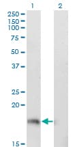 STMN1 / Stathmin / LAG Antibody (clone 3A9)