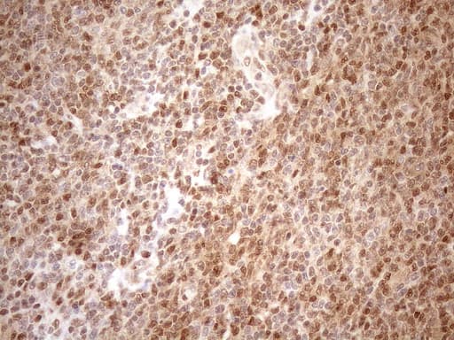 MGMT Antibody (clone OTI2E2)