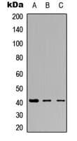 Polyclonal Rabbit anti-Human NT5C1A / CN1A Antibody (Internal, IF, WB)