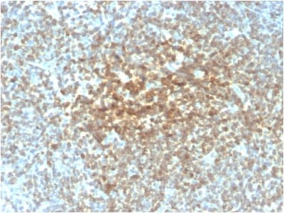 Recombinant Monoclonal Mouse anti-Human BCL2 / Bcl-2 Antibody (clone rBCL2/782, Azide-free,Carrier-free, IHC, IF, WB)