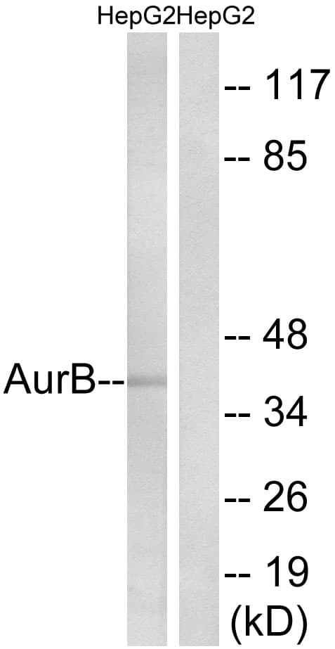 IHC-plus™ Polyclonal Rabbit anti-Human AURKB / Aurora-B Antibody (aa1-50, IHC, IF, WB)