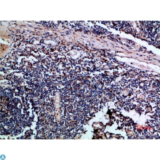 CSTA / Cystatin A Antibody