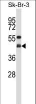 Polyclonal Rabbit anti-Human GNAI2 Antibody (aa78-107, WB)