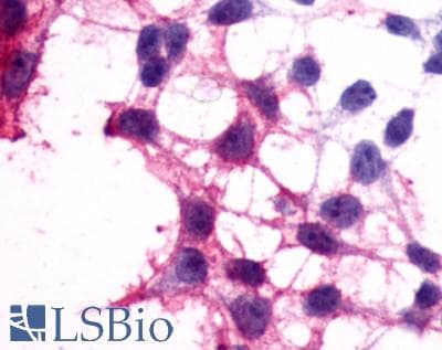 PathPlus™ Polyclonal Rabbit anti-Human P2RY12 / P2Y12 Antibody (N-Terminus, IHC)