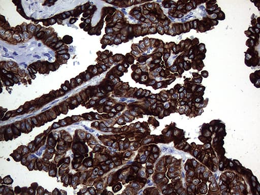 KRT16 / CK16 / Cytokeratin 16 Antibody (clone OTI2F3)