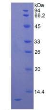 Human IL8 / Interleukin 8 Protein (Recombinant His)