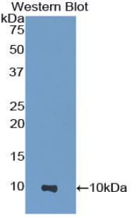 HPSE / Heparanase Antibody (aa353-464, APC)
