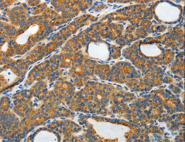 Polyclonal Rabbit anti-Human RAMP3 Antibody (IHC)