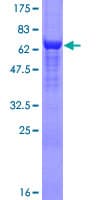 Human EIF4A3 Protein (Recombinant GST)
