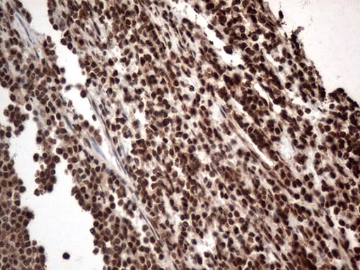 Monoclonal Mouse anti-Human KARS Antibody (clone OTI1E7, IHC, WB)