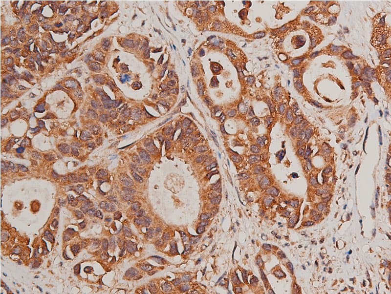 Polyclonal Rabbit anti-Human CYP17 / CYP17A1 Antibody (IHC, IF, WB)
