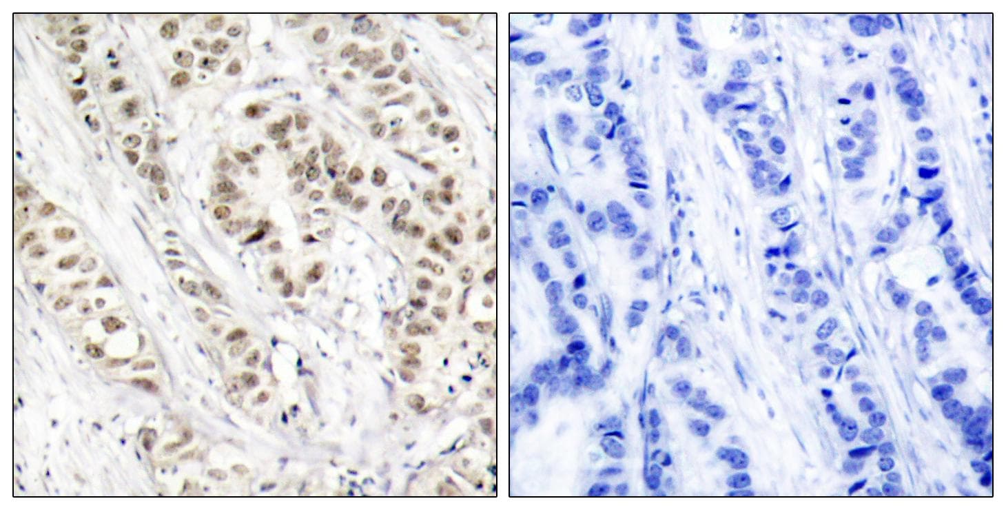Polyclonal Rabbit anti-Human BRCA1 Antibody (phospho-Ser1524, IHC)