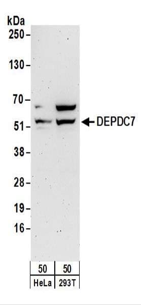 DEPDC7 Antibody (aa461-511)