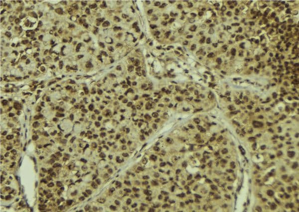 Polyclonal Rabbit anti-Human MGEA5 Antibody (IHC, WB)