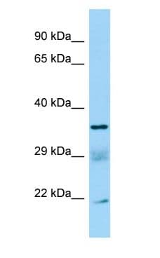 SUCLG1 / GALPHA Antibody (C-Terminus)