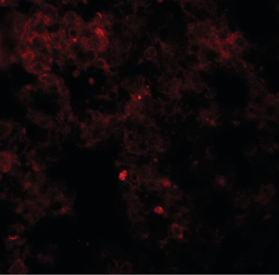 Polyclonal Rabbit anti-Human Coronin 7 / CORO7 Antibody (IHC, IF, WB)
