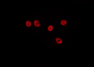 ZNF460 Antibody