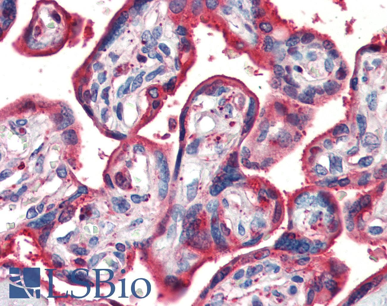 PathPlus™ Monoclonal Mouse anti-Human CALR / Calreticulin Antibody (clone 5F12-B10, IHC, WB)