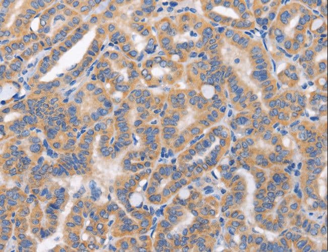 Polyclonal Rabbit anti-Human CARD17 / INCA Antibody (IHC)