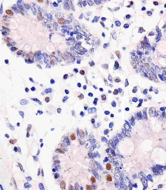GAPDH Antibody (clone 1653CT401.3.33)
