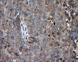 PRKAR2A Antibody (clone OTI4H8, Carrier-free)