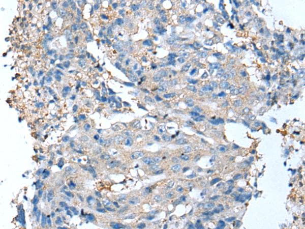 DCX / Doublecortin Antibody