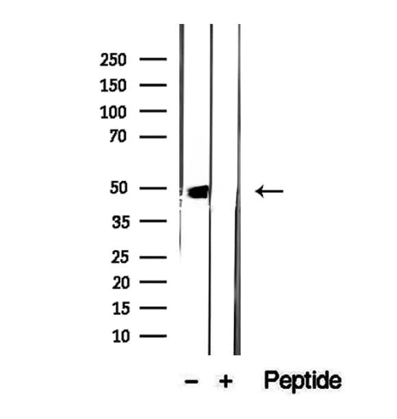 DDC / DOPA Decarboxylase Antibody