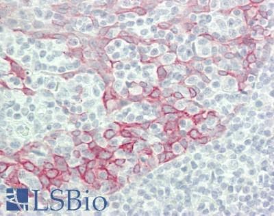 IHC-plus™ Polyclonal Rabbit anti-Human IFNA4 / Interferon Alpha 4 Antibody (aa162-189, IHC, WB)