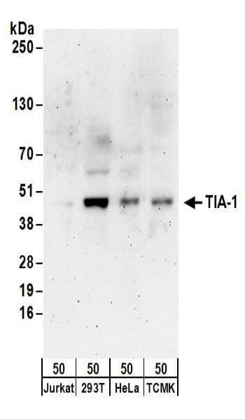 Polyclonal Rabbit anti-Human TIA-1 Antibody (aa1-50, WB)