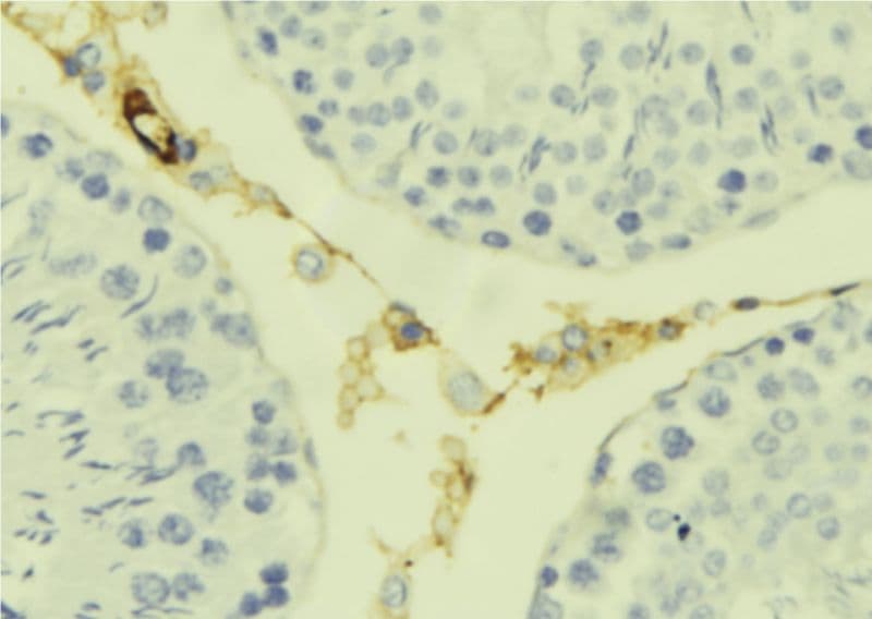 KLK7 / Kallikrein 7 Antibody