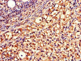 Polyclonal Rabbit anti-Human QDPR / DHPR Antibody