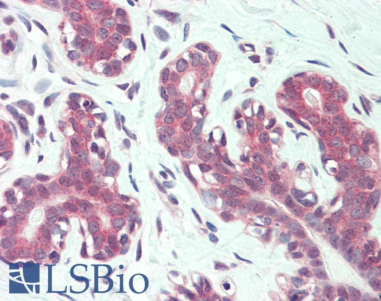 IHC-plus™ ITGA6/Integrin Alpha 6/CD49f Antibody (N-Terminus)