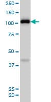 EPHA4 / EPH Receptor A4 Antibody (clone 6H7)